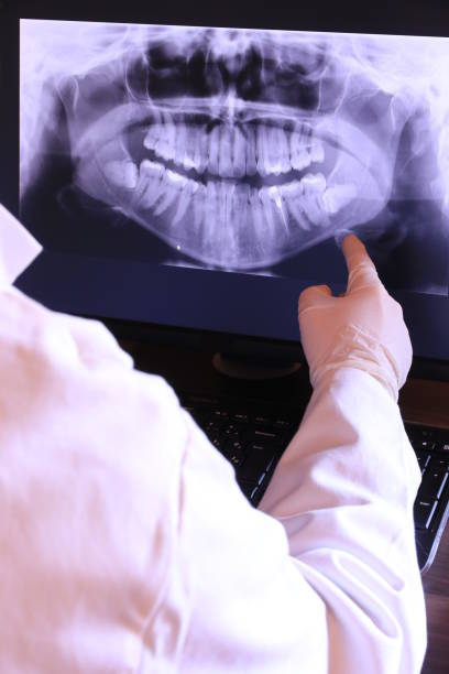 Best Broken or Cracked Tooth Emergency Dentist in Hamlin, WV